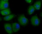 TLR4 Antibody in Immunocytochemistry (ICC/IF)