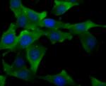 TLR4 Antibody in Immunocytochemistry (ICC/IF)