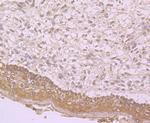 TLR4 Antibody in Immunohistochemistry (Paraffin) (IHC (P))