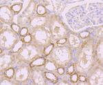 TLR4 Antibody in Immunohistochemistry (Paraffin) (IHC (P))