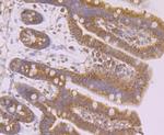 TLR4 Antibody in Immunohistochemistry (Paraffin) (IHC (P))