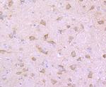 GRP78 Antibody in Immunohistochemistry (Paraffin) (IHC (P))