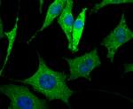 LRRK2 Antibody in Immunocytochemistry (ICC/IF)