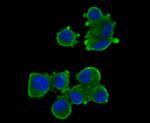 LRRK2 Antibody in Immunocytochemistry (ICC/IF)