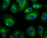 LRRK2 Antibody in Immunocytochemistry (ICC/IF)