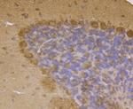 LRRK2 Antibody in Immunohistochemistry (Paraffin) (IHC (P))