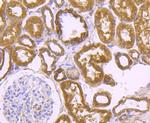 LRRK2 Antibody in Immunohistochemistry (Paraffin) (IHC (P))