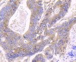 JAK2 Antibody in Immunohistochemistry (Paraffin) (IHC (P))