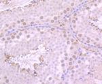 USP36 Antibody in Immunohistochemistry (Paraffin) (IHC (P))