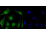 FBXW7 Antibody in Immunocytochemistry (ICC/IF)