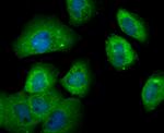 FOXO3A Antibody in Immunocytochemistry (ICC/IF)