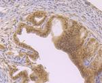 FOXO3A Antibody in Immunohistochemistry (Paraffin) (IHC (P))