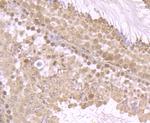 FOXO3A Antibody in Immunohistochemistry (Paraffin) (IHC (P))