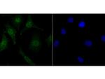 LSD1 Antibody in Immunocytochemistry (ICC/IF)