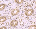 LSD1 Antibody in Immunohistochemistry (Paraffin) (IHC (P))