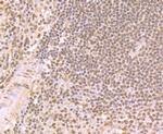 LSD1 Antibody in Immunohistochemistry (Paraffin) (IHC (P))