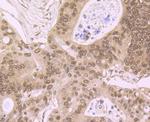 LSD1 Antibody in Immunohistochemistry (Paraffin) (IHC (P))