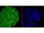 Progesterone Receptor Antibody in Immunocytochemistry (ICC/IF)