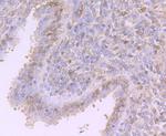 Progesterone Receptor Antibody in Immunohistochemistry (Paraffin) (IHC (P))