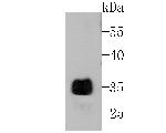 Alpha-1 acid glycoprotein Antibody in Western Blot (WB)