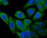 Apolipoprotein A1 Antibody in Immunocytochemistry (ICC/IF)