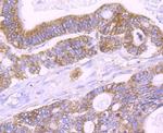 IL-1 alpha Antibody in Immunohistochemistry (Paraffin) (IHC (P))