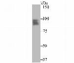 Progesterone Receptor Antibody in Western Blot (WB)