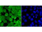 Dnmt3b Antibody in Immunocytochemistry (ICC/IF)