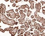 Dnmt3b Antibody in Immunohistochemistry (Paraffin) (IHC (P))