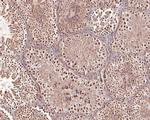 Dnmt3b Antibody in Immunohistochemistry (Paraffin) (IHC (P))