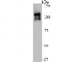 Dnmt3b Antibody in Western Blot (WB)