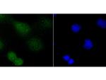 PARP1 Antibody in Immunocytochemistry (ICC/IF)