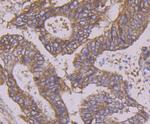 Apg3 Antibody in Immunohistochemistry (Paraffin) (IHC (P))