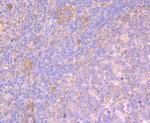 Apg3 Antibody in Immunohistochemistry (Paraffin) (IHC (P))