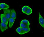 Bcl-2 Antibody in Immunocytochemistry (ICC/IF)