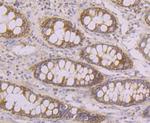 Tyk2 Antibody in Immunohistochemistry (Paraffin) (IHC (P))