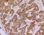 Tyk2 Antibody in Immunohistochemistry (Paraffin) (IHC (P))