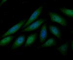 LOXL2 Antibody in Immunocytochemistry (ICC/IF)