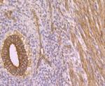 LOXL2 Antibody in Immunohistochemistry (Paraffin) (IHC (P))