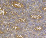 CASK Antibody in Immunohistochemistry (Paraffin) (IHC (P))