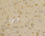 CASK Antibody in Immunohistochemistry (Paraffin) (IHC (P))