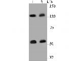 CASK Antibody in Western Blot (WB)