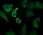 Annexin A1 Antibody in Immunocytochemistry (ICC/IF)