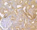 IL-22 Antibody in Immunohistochemistry (Paraffin) (IHC (P))