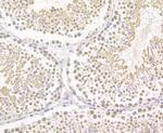 Brd4 Antibody in Immunocytochemistry (ICC/IF)