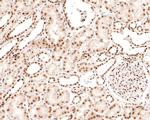 Brd4 Antibody in Immunohistochemistry (Paraffin) (IHC (P))