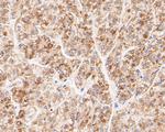 FH Antibody in Immunocytochemistry (ICC/IF)