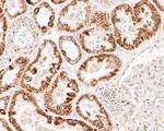 FH Antibody in Immunohistochemistry (Paraffin) (IHC (P))