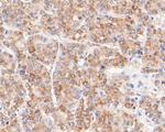 FH Antibody in Immunohistochemistry (Paraffin) (IHC (P))