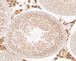 FH Antibody in Immunohistochemistry (Paraffin) (IHC (P))